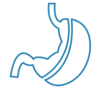 GASTRIC-SLEEVE