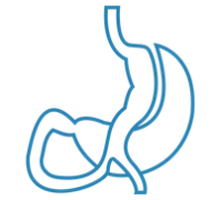 MINI-GASTRIC-BYPASS